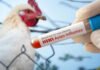 Bird Flu Outbreak in Udham Singh Nagar Kills Over 5,000 Chickens; Restrictions Imposed Bird flu